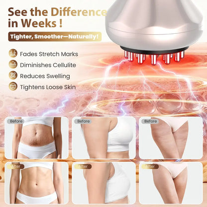 Steadrex GlowRitual Red Light Massager with Heat & Vibration + FREE Oil Massager